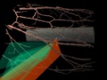 [Preoperative Planning and Training Simulation for Risk Reducing Surgery]