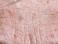 [Facial Skin Aging: an overview of biological aging processes]